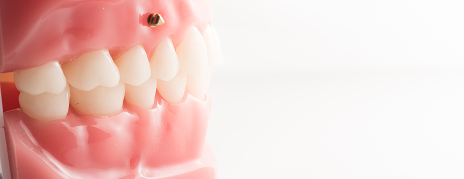 Dentisterie Neuromusculaire