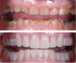 Esthétique du sourire